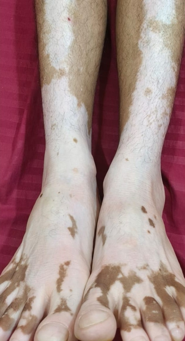 Before - Daniel: Healing the Challenging Cases.